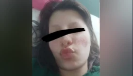 Türbanlı Snapte