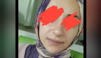 Türbanlı Genç Kız 2